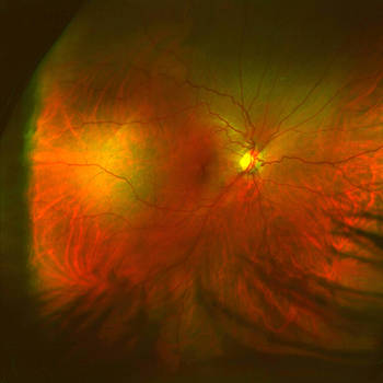 My Eye!